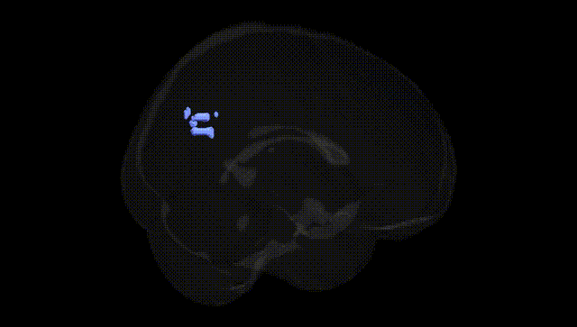 Full Brain Black