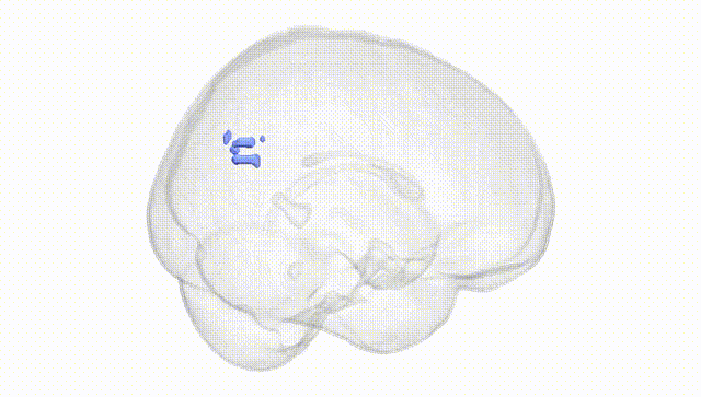 Full Brain White