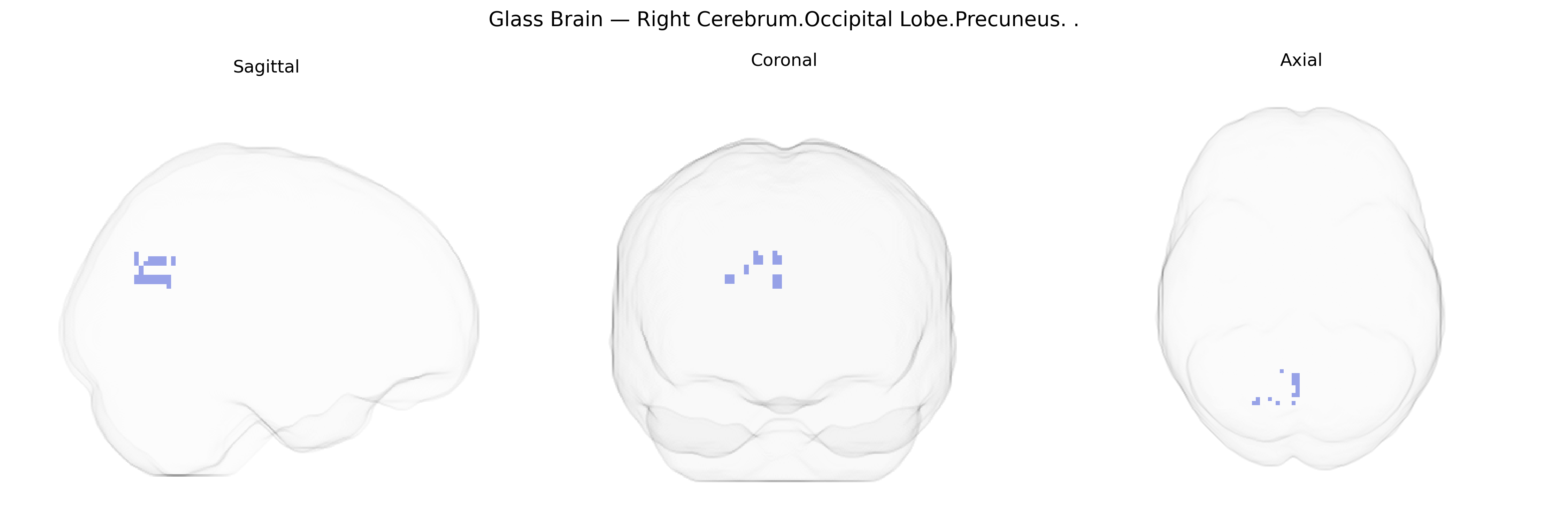Triplanar Ghost Brain