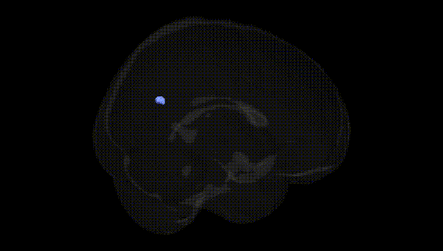 Full Brain Black