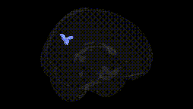 Full Brain Black