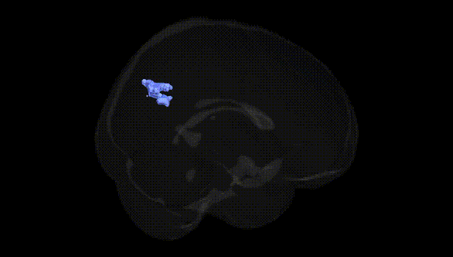 Full Brain Black
