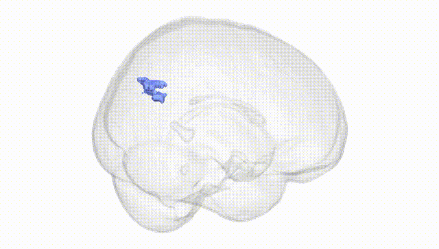 Full Brain White