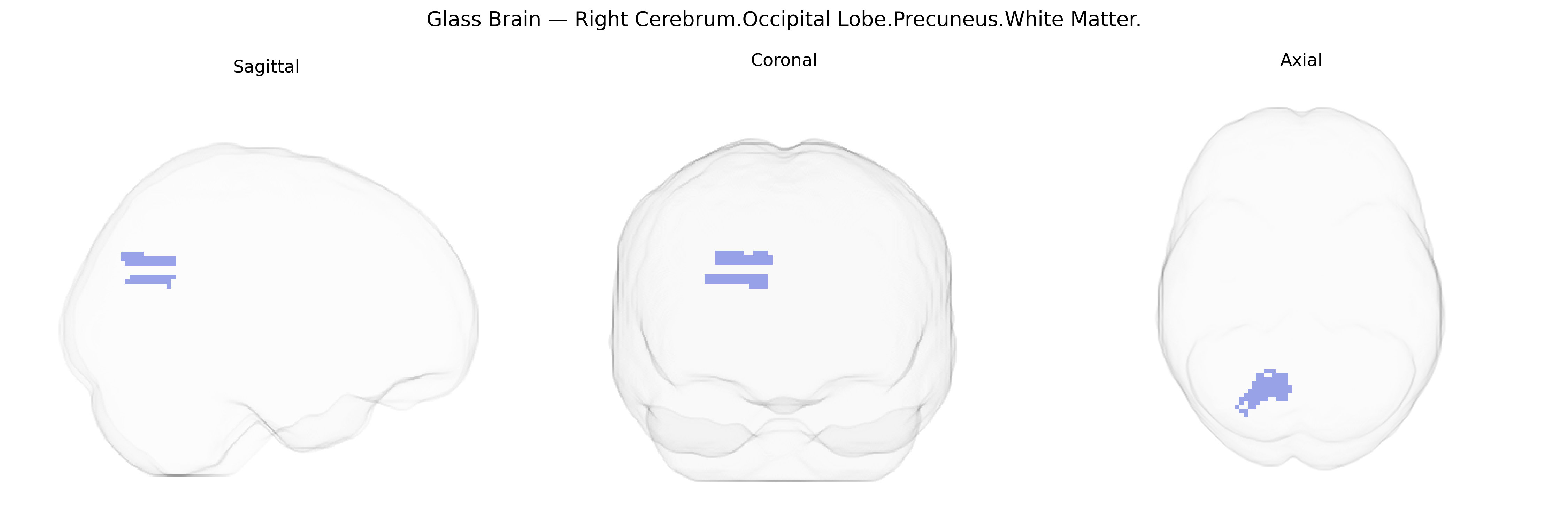 Triplanar Ghost Brain