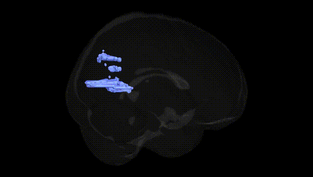 Full Brain Black