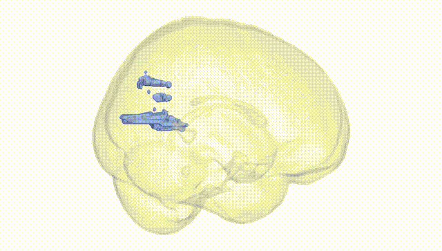 Full Brain White