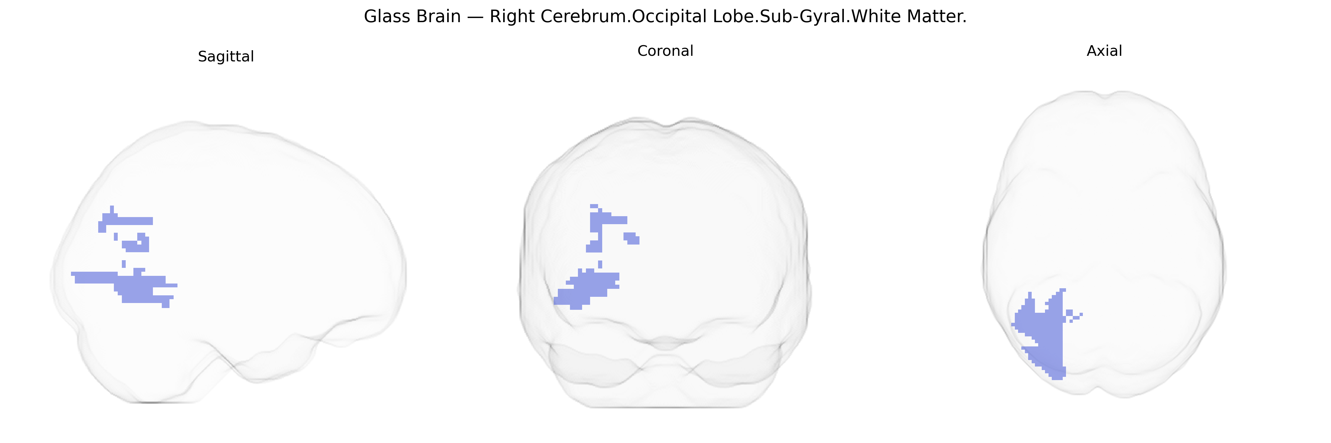 Triplanar Ghost Brain