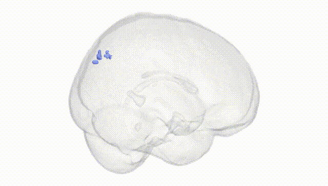Full Brain White