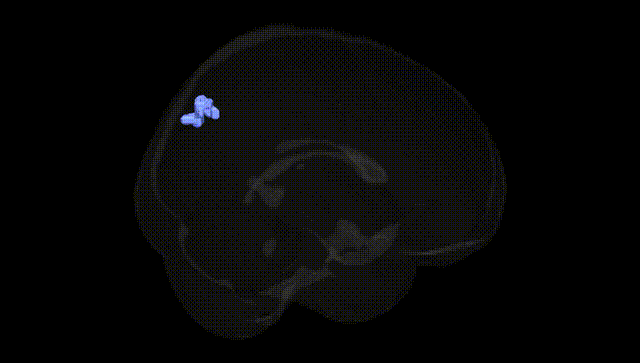 Full Brain Black