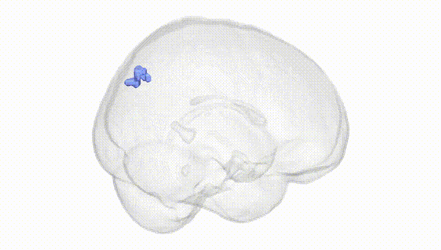 Full Brain White