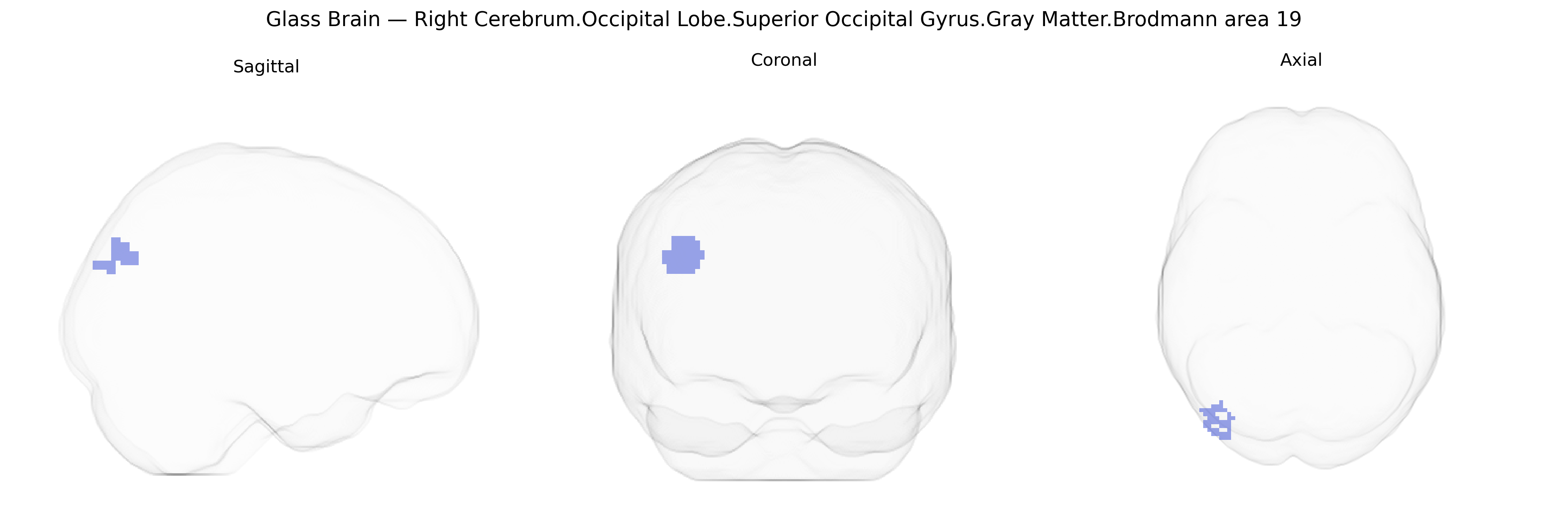 Triplanar Ghost Brain