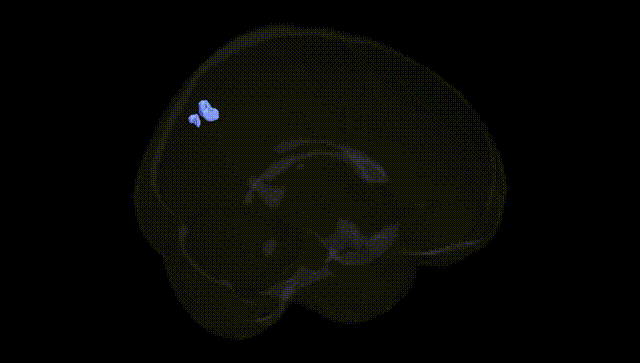 Full Brain Black