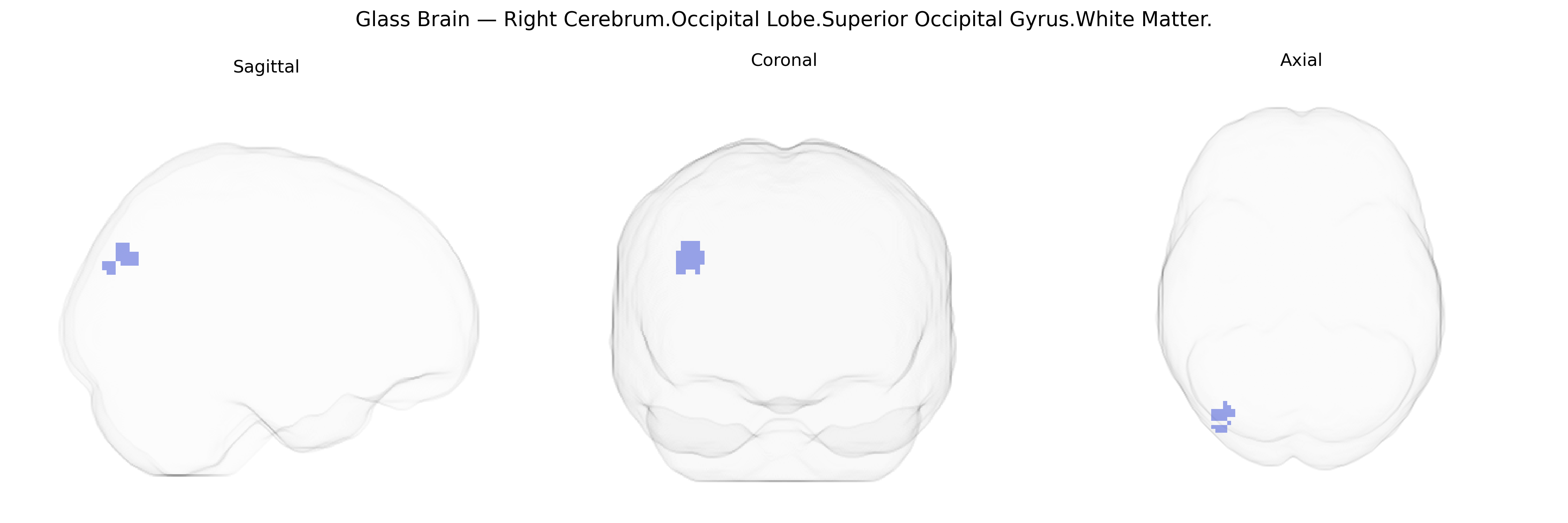 Triplanar Ghost Brain