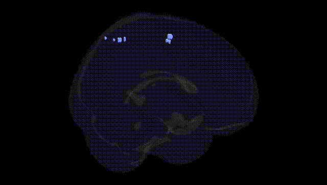 Full Brain Black