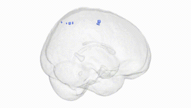 Full Brain White
