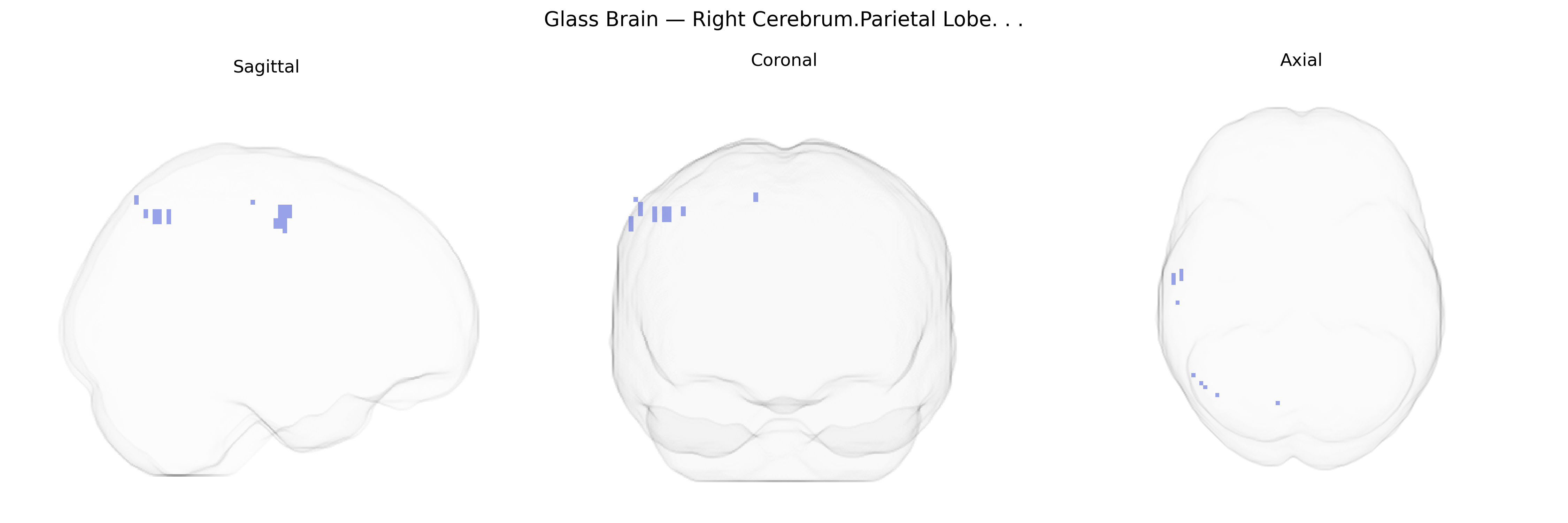 Triplanar Ghost Brain