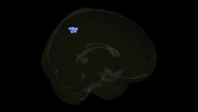 Full Brain Black