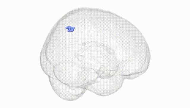 Full Brain White