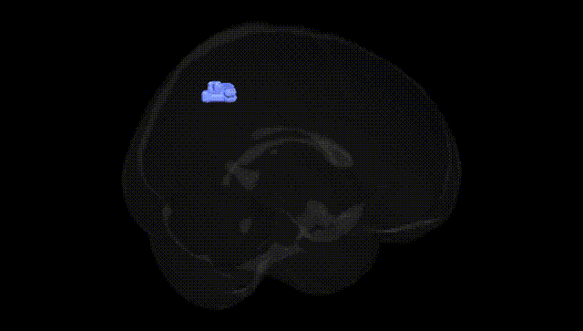 Full Brain Black