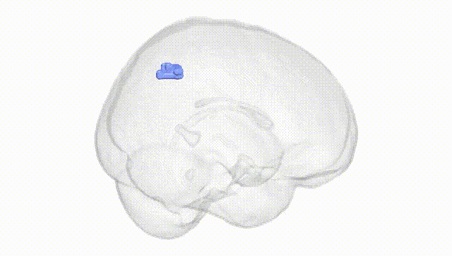 Full Brain White