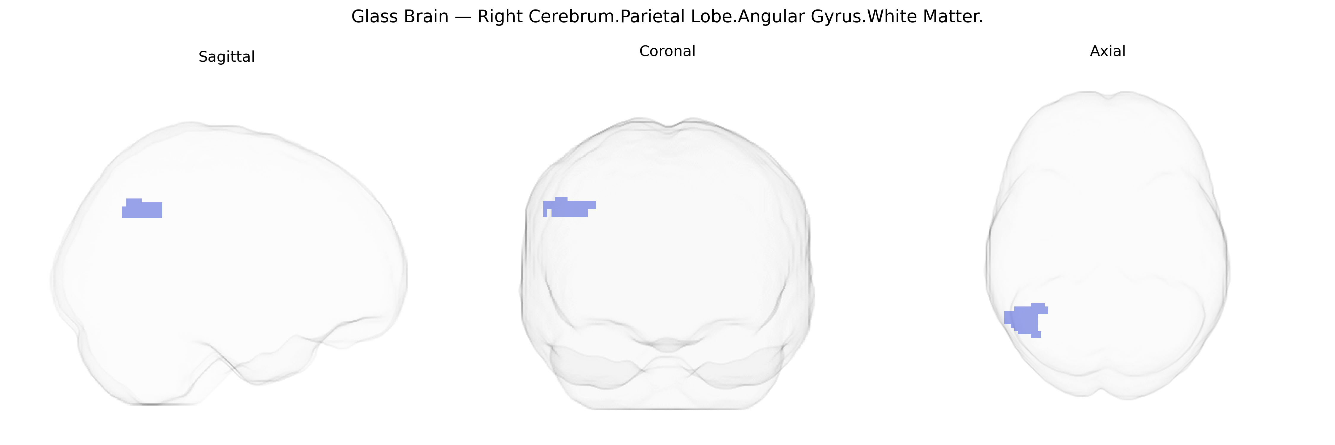 Triplanar Ghost Brain