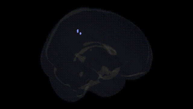 Full Brain Black