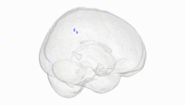 Full Brain White