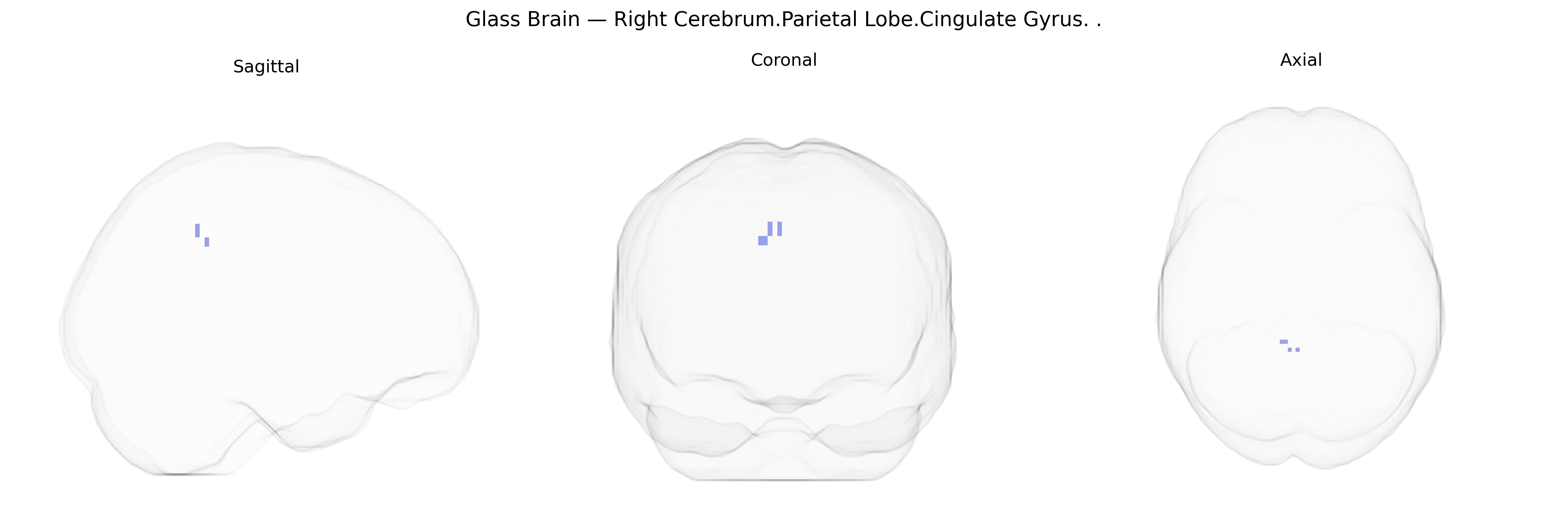 Triplanar Ghost Brain