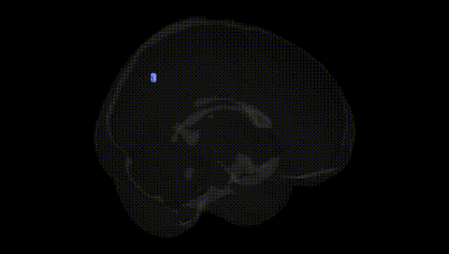 Full Brain Black