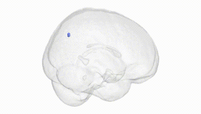 Full Brain White