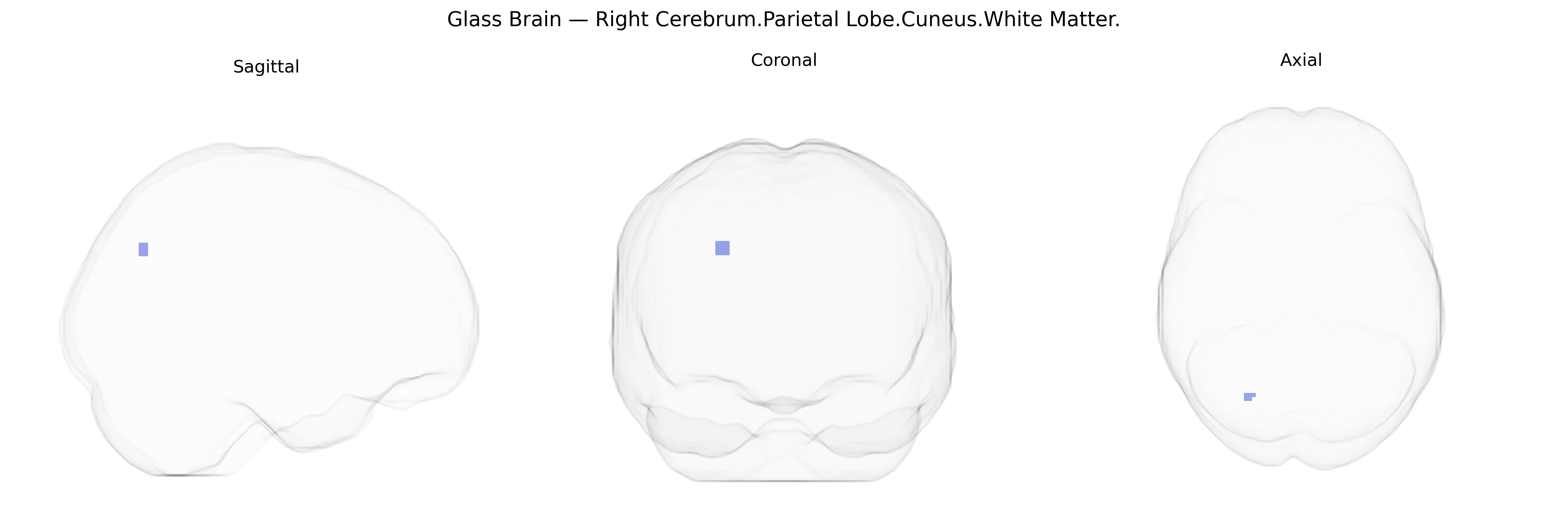 Triplanar Ghost Brain