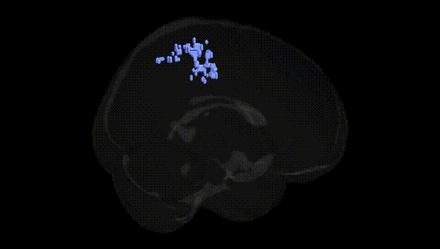 Full Brain Black