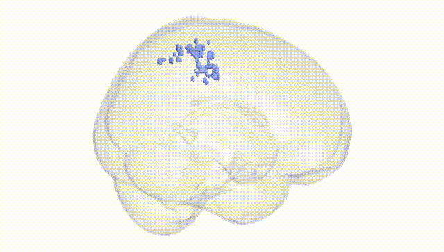Full Brain White