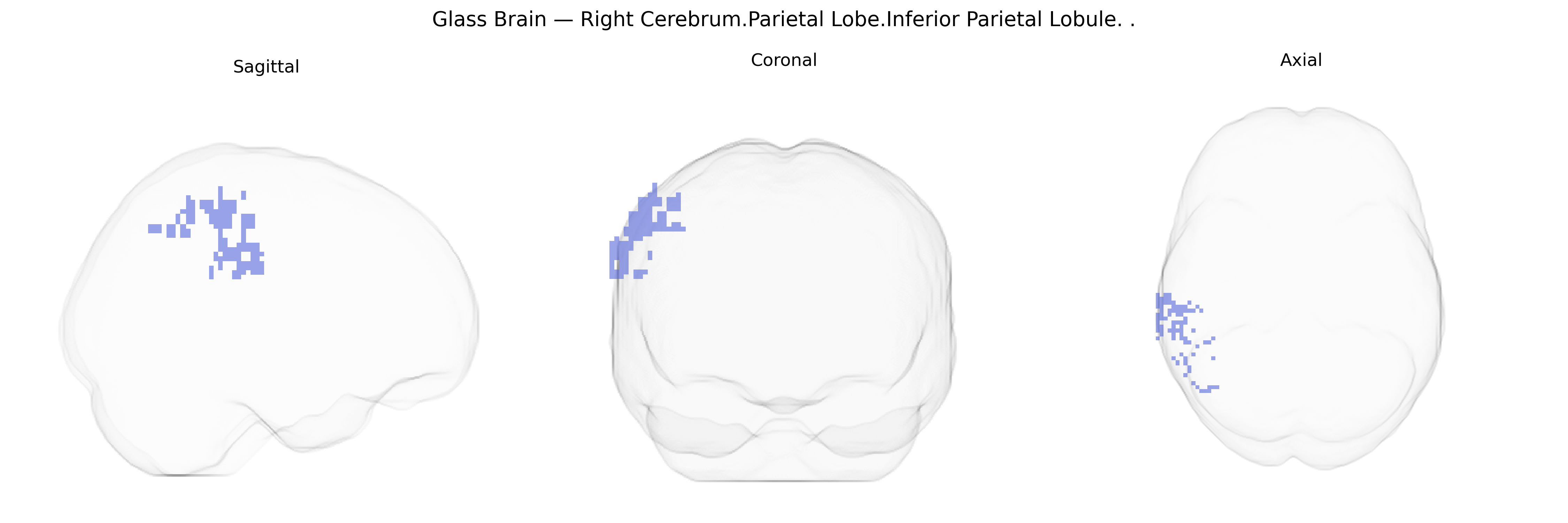 Triplanar Ghost Brain