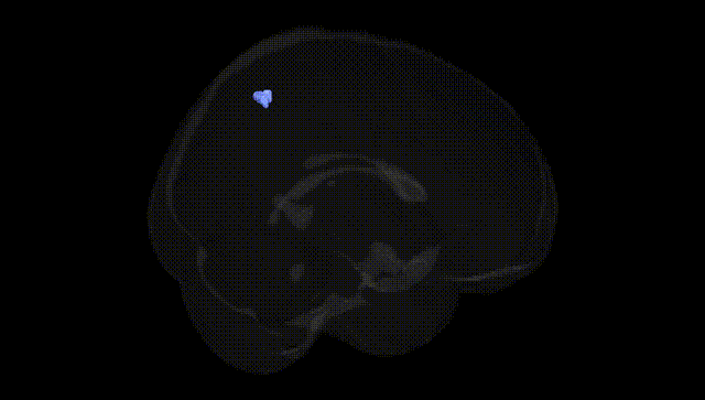 Full Brain Black