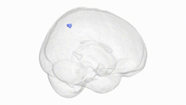 Full Brain White