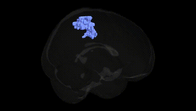 Full Brain Black