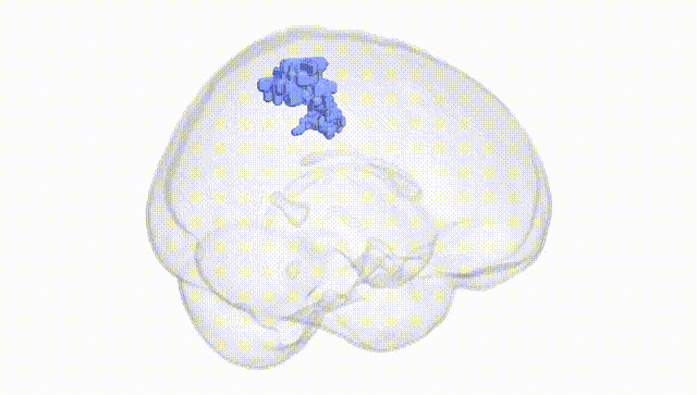 Full Brain White
