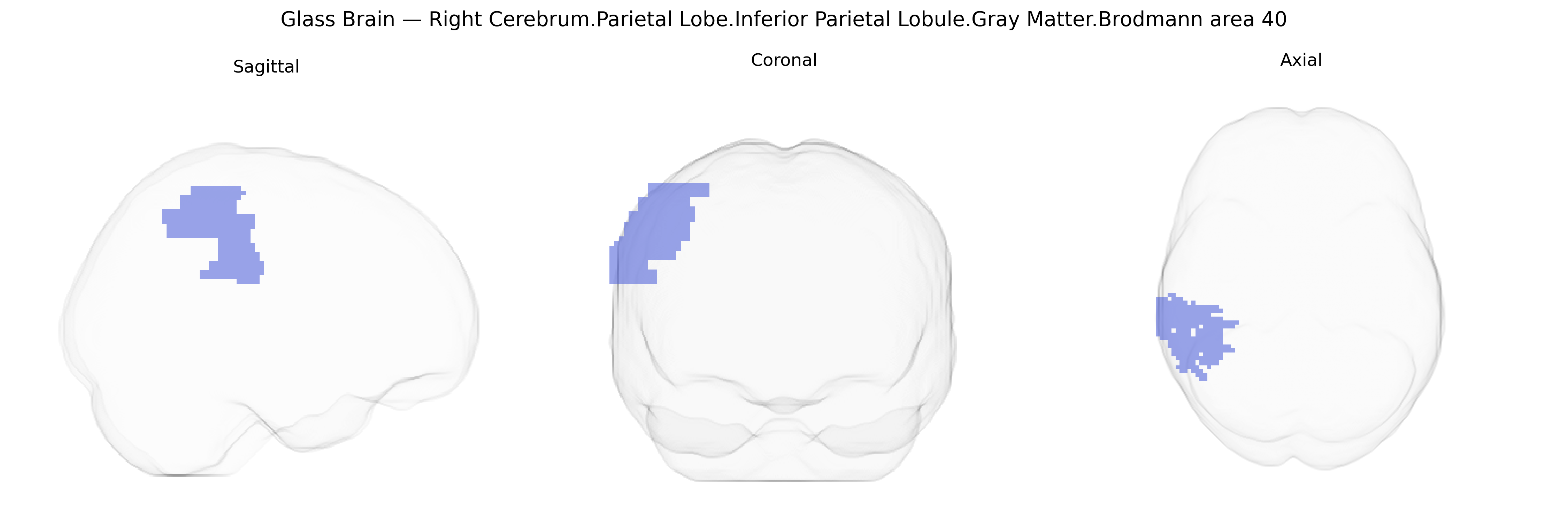 Triplanar Ghost Brain