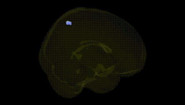 Full Brain Black
