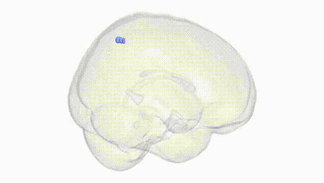 Full Brain White
