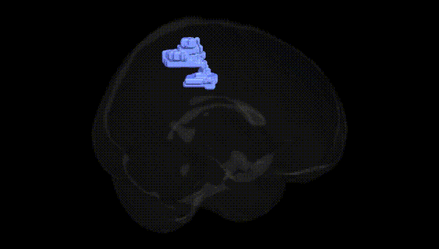 Full Brain Black