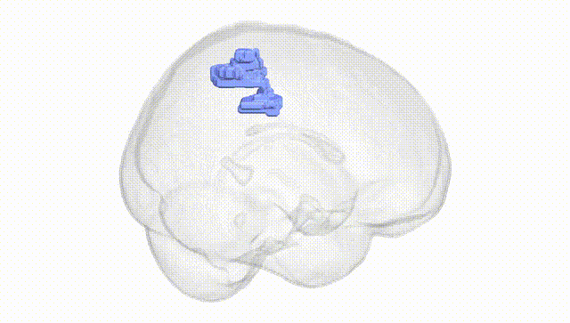 Full Brain White