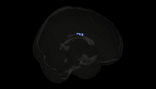 Full Brain Black
