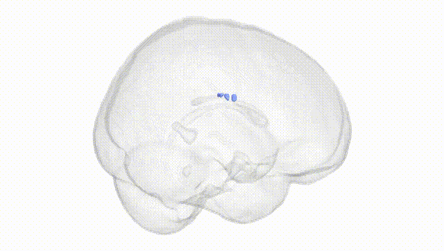 Full Brain White