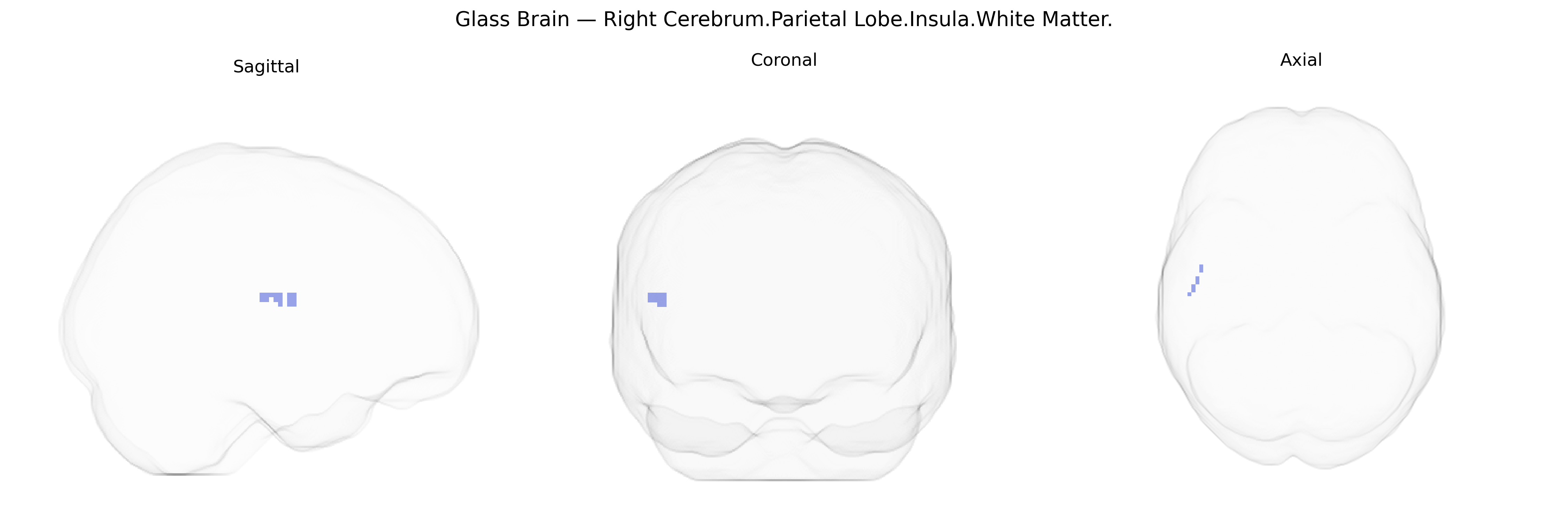 Triplanar Ghost Brain