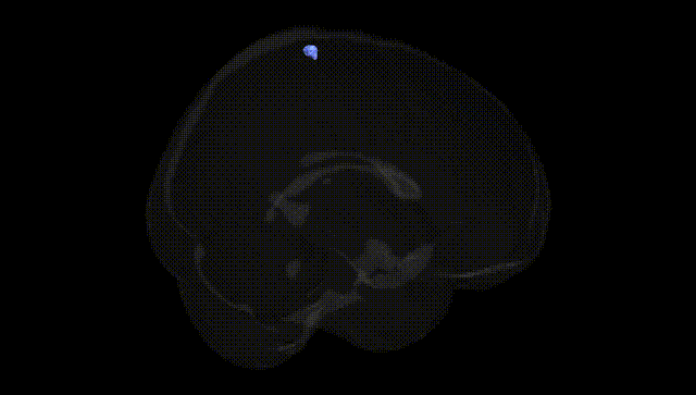 Full Brain Black