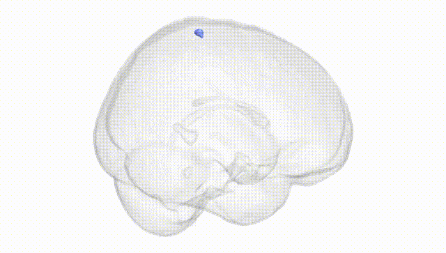 Full Brain White