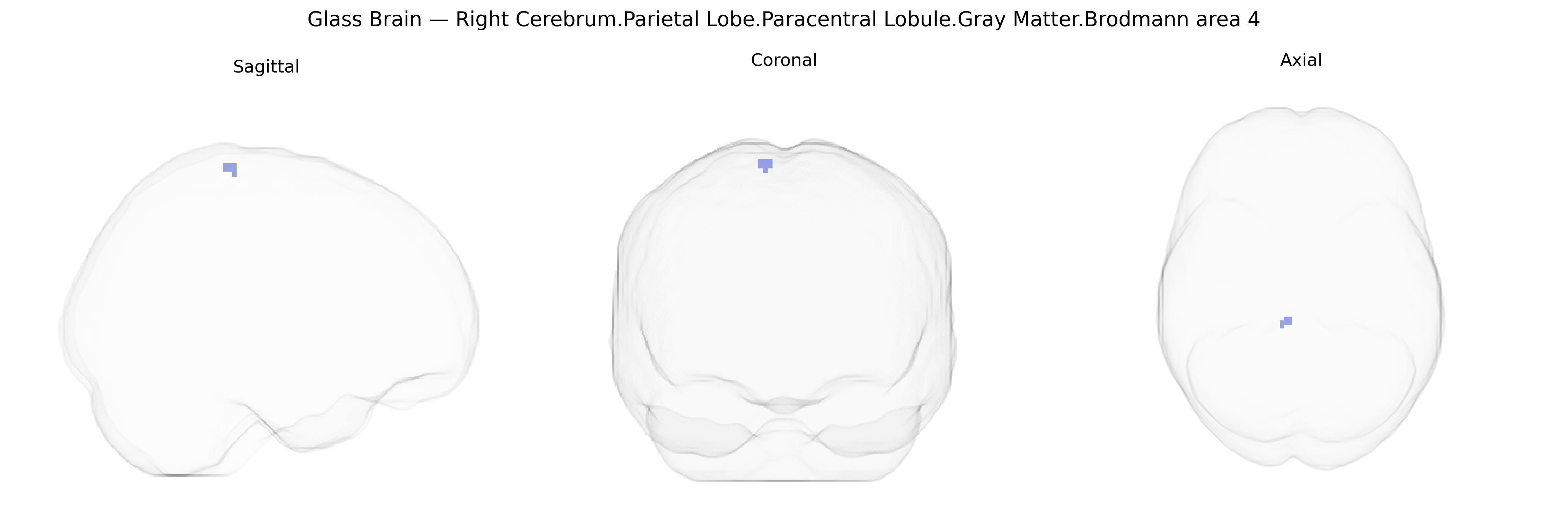 Triplanar Ghost Brain
