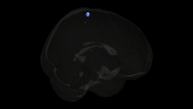 Full Brain Black